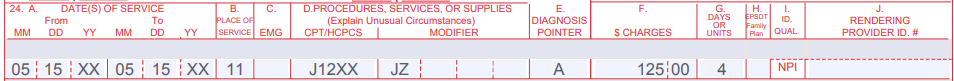 JZ modifier billing example 2
